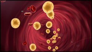 Breakthrough in Cholesterol and Cancer Research