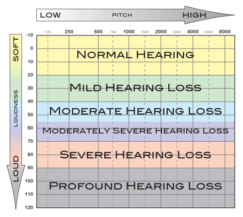 Denied VA Hearing Loss Claim? Here’s How to Fight Back and Win Benefits 3 Color coded hearing loss levels